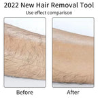 Crystal Hair Remover